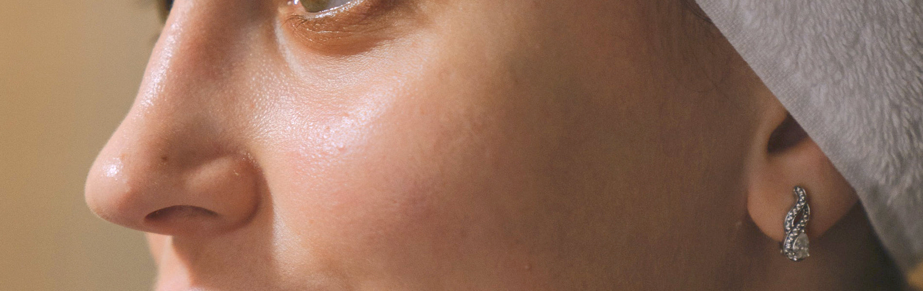 Why do my pores look so big?