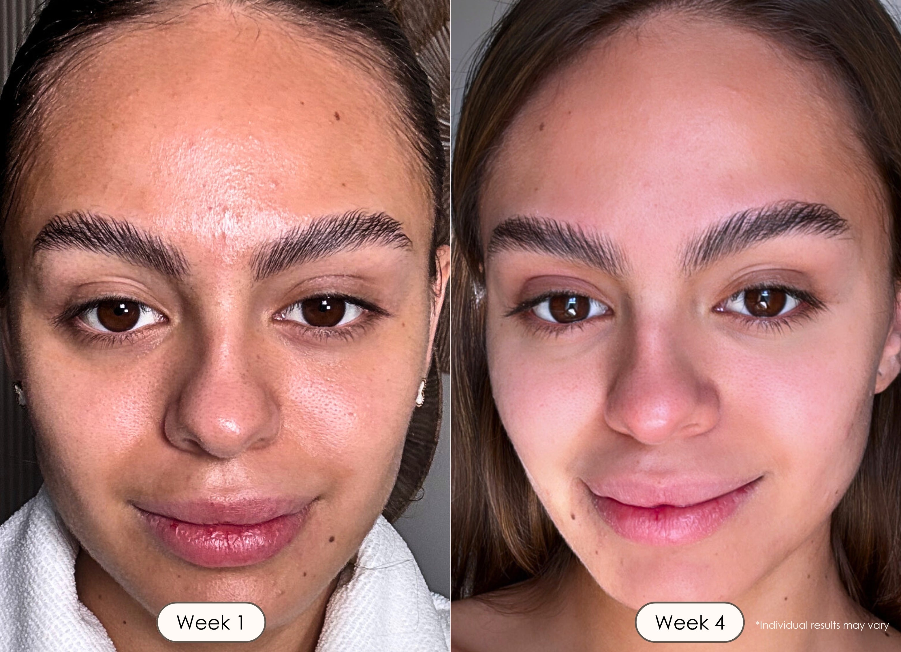 Visible results after 4 weeks of using LumaLux Face