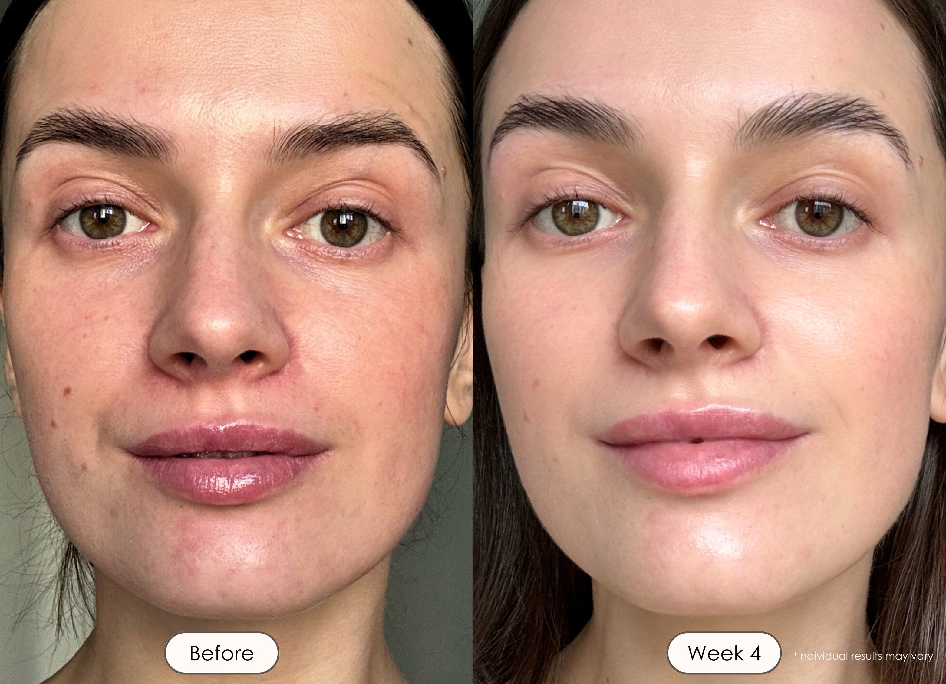 Empowering Your Skin Journey | LED Light Therapy | Project E Beauty